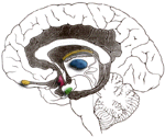 Focal Neurological Deficits caused by focal injury to the brain.
